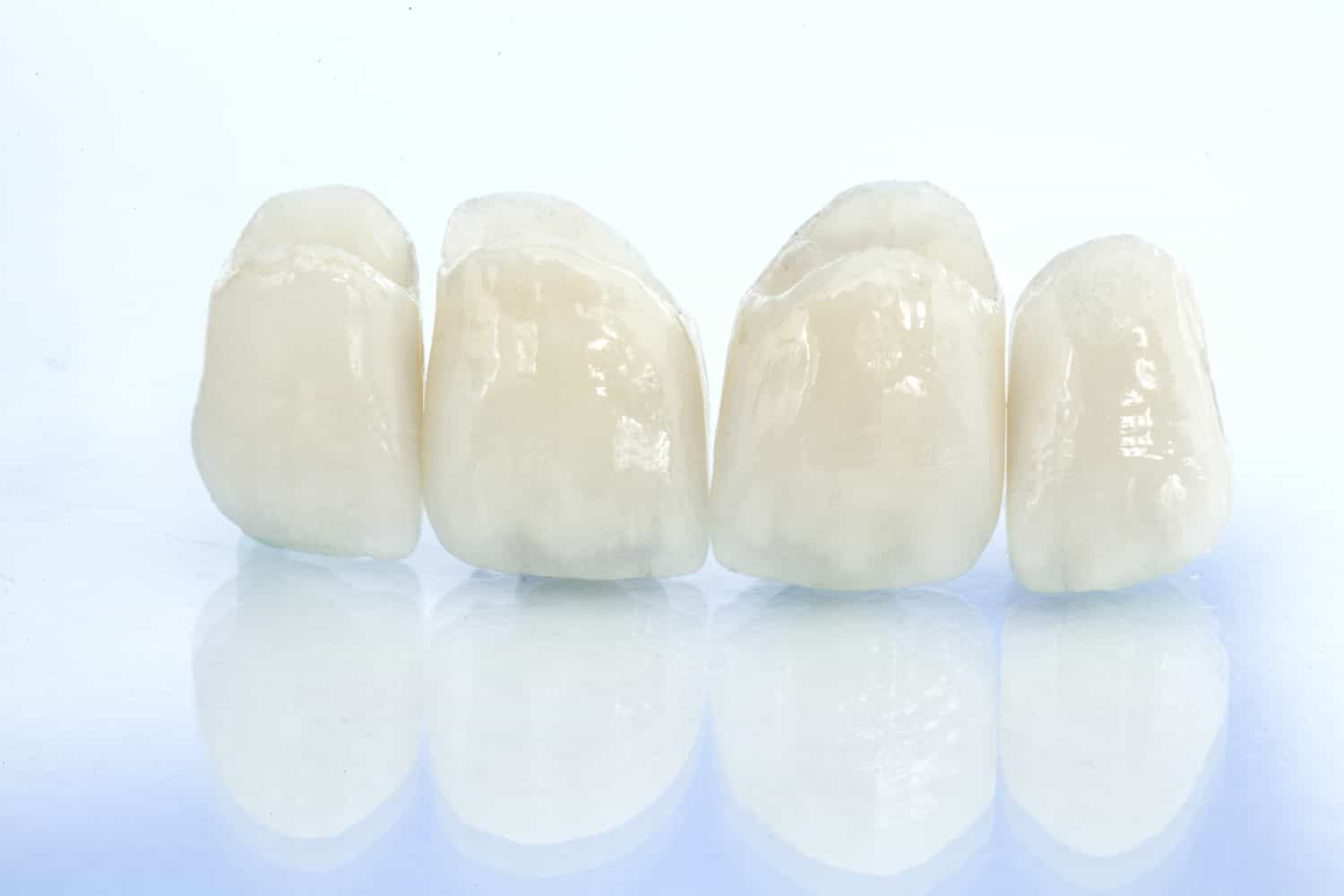 Porcelain Crown and Bridge | General & Cosmetic Dentist Harrisburg, PA |  Aziz A. Majid DMD, MSD, PC